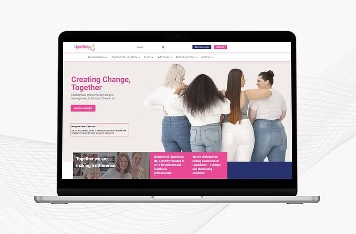 Lipoedema UK website on a laptop